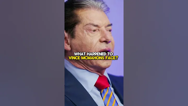 What happened to Vince McMahons face? 🤡 #wweshorts #wwe