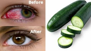 You will drop those glasses at home, improve your eyesight in 3 days, correct bad eyesight fast