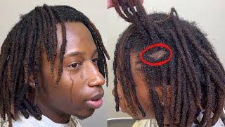 All of his hair had to go because of this stress spot