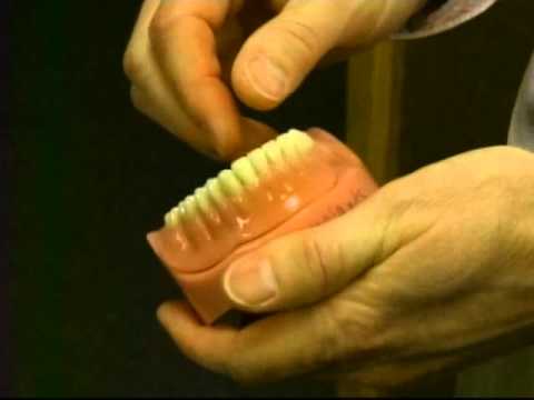 Tupelo Dentist- Dr. Richard Caron's "Your Dental Health" Dentures-Mini- Implants