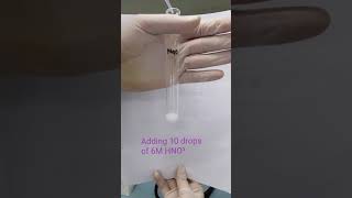 Chloride Test (Sodium Chloride)
