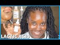 THE ORDINARY LACTIC ACID 5 & MY PEELING DRY SKIN! 3 WEEKS UPDATE| JWILLSCOOL