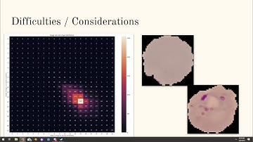 Detecting Malaria using Convolutional Neural Networks [PyTorch]