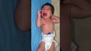 Newborn baby misbaped with heads and characteristics in his mother abnormal weight