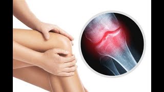 Diseases of bone;  Congenital Disorders, Metabolic, Inflammatory & Infective