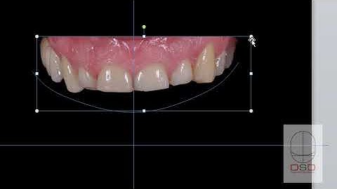 DSD step by step for powerpoint phase 2