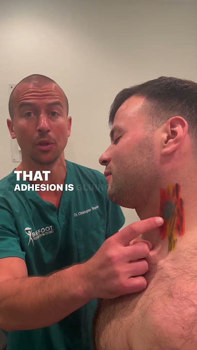 The most common spot for chronic #neckpain to check for adhesion
