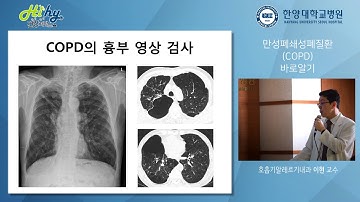 만성폐쇄성폐질환(COPD)바로알기