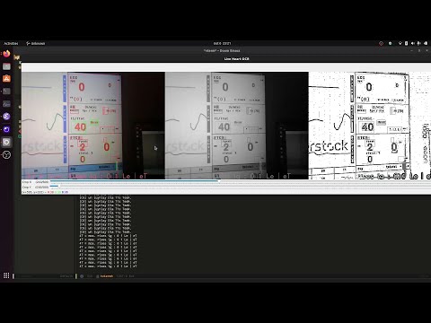 Real-time text detection software using  technologies: ESP32-Cam, Tesseract OCR, OpenCV, Tensorflow