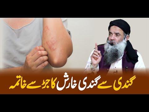 KHarish KA Fori Ilaj KHarish KA GHarelo ILaj KHarish KA Ilaj By Dr SHarafat Ali 