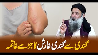 Kharish Ka Fori Ilaj  Kharish Ka Gharelo Ilaj  Kharish Ka Ilaj  By Dr Sharafat Ali