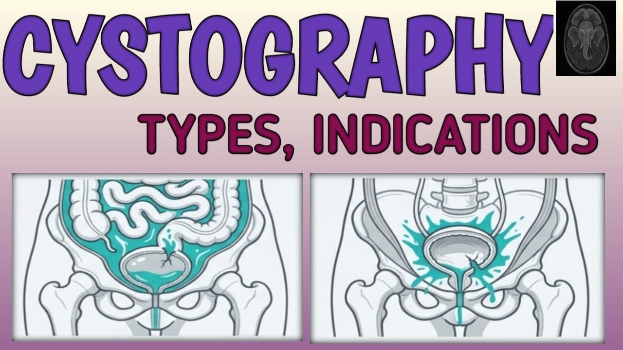 IMAGING URINARY BLADDER ! CYSTOGRAPHY explained ! #cystoscopy # ...