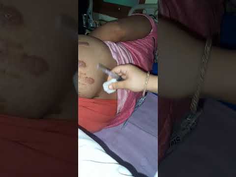 Injection new vlog girl| Injection on hip crying vlog| Injection funny video | daily Injection video