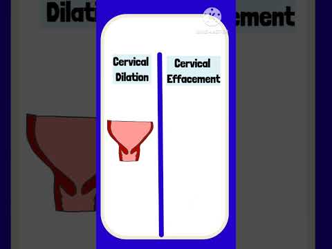 Cervical Dilation vs