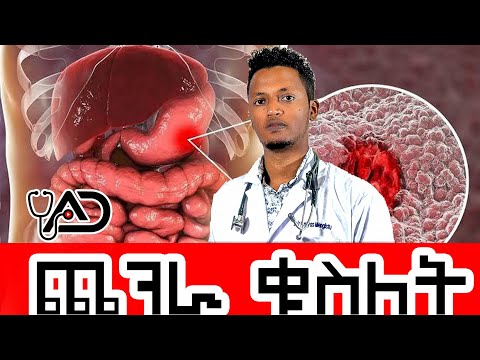 ቪዲዮ: የጨጓራ ቁስለት አደገኛ ነው?