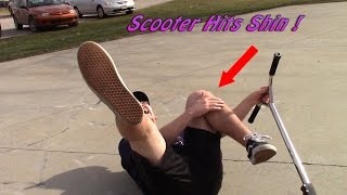 Scooter Hits Shin