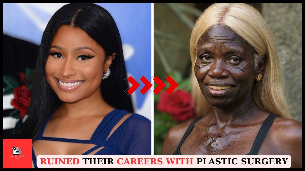 Top 20 Black celebrities Who RUINED Their Careers With PLASTIC SURGERY Part 2 | Then and now 2024 - YouTube