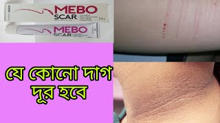 Mebo Scarযকন দগ দর হব দবইযর বখযত মব এসকর করম
