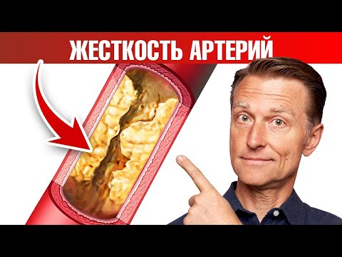 Кальцификация сосудов, жесткость артерий 👉 причина №1