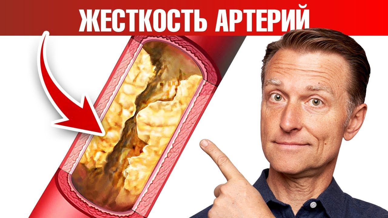 Кальцификация сосудов, жесткость артерий 👉 причина №1 - YouTube