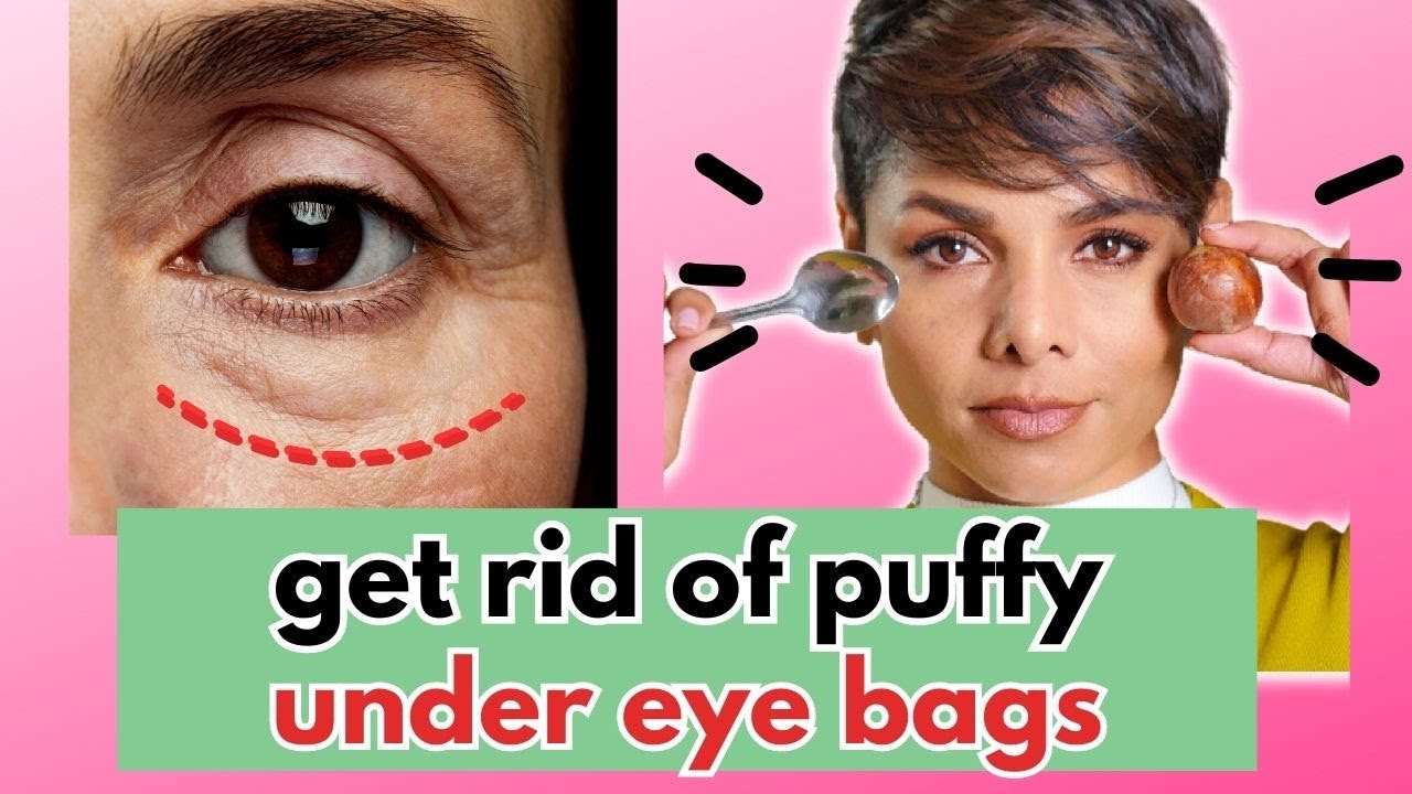 Home Remedies To Treat Eye Bags Naturally  Dream Plastic Surgery