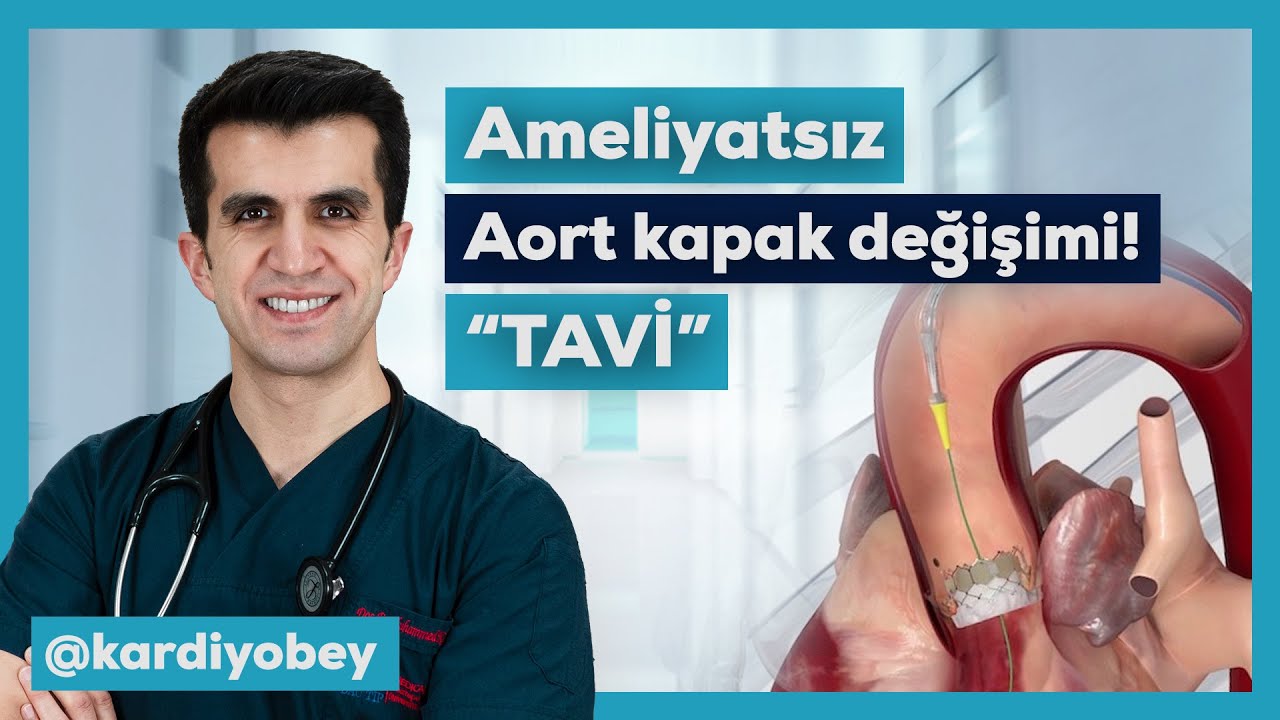 Ameliyatsız Aort Kapak Değişimi ( TAVİ )