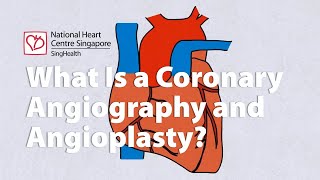 The lifesaving procedure you need to know about  Coronary Angiography