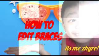 vlog#40 how to edit braces on application screenshot 5