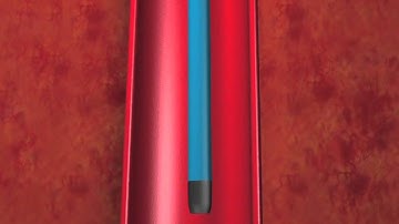 EN Snare® Endovascular Snare & Catheter Animation