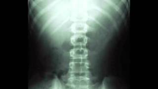 MALMSTROM CHIROPRACTIC CLINIC Topeka KS