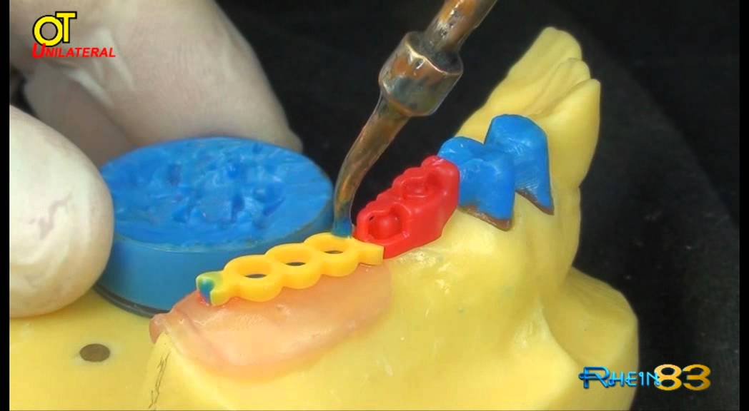 Rhein 83 Unilateral ITA