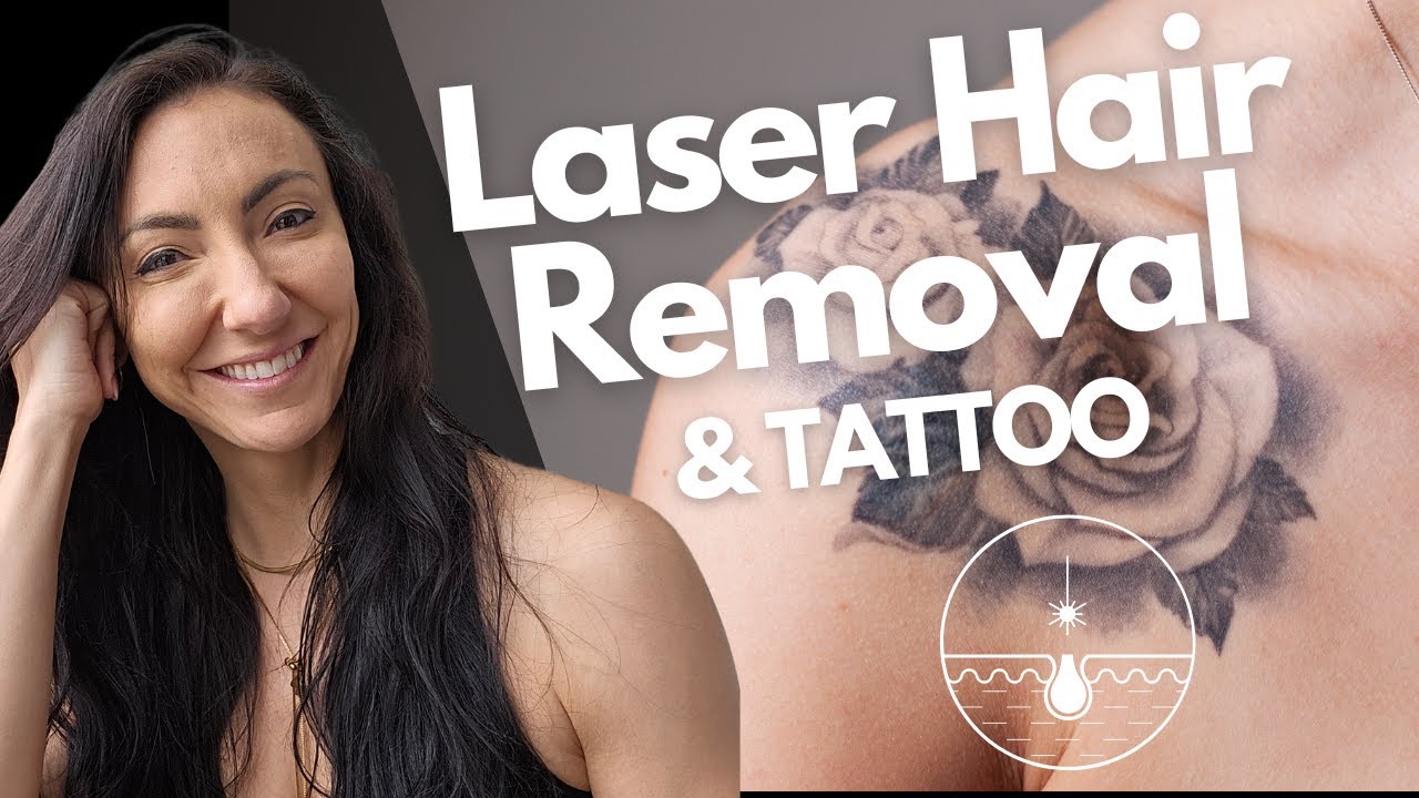 Does Laser Hair Removal damage tattoos  London Premier Laser  Skin Clinic