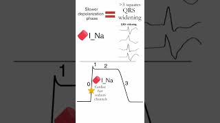 TCA cardiotoxicity USMLE #usmlestep1 #usmleprep #depolarization #TCAtoxicity #Torsades