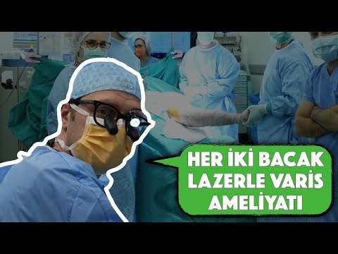 Her İki Bacak İçin Lazerle Varis Ameliyatı