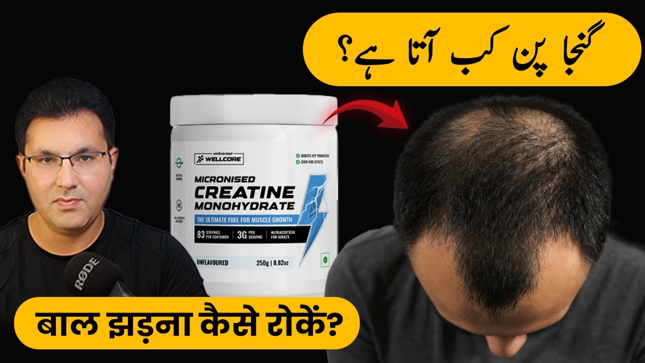 Creatine and Hair Loss | क्रिएटिन और बाल झड़ना