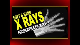 Soft and Hard X–Rays and Properties of X–Rays | Physics4students screenshot 4