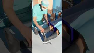 Man Freezes Legs For Insurance Fraud