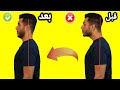 بروز الرأس للامام اسبابه وعلاجه اهم التمارين لعلاج تقوس وتحدب الرقبه