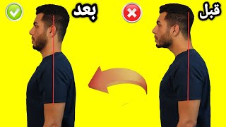 بروز الرأس للامام اسبابه وعلاجه| اهم التمارين لعلاج تقوس وتحدب الرقبه