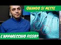 A che età si mette l'apparecchio fisso?