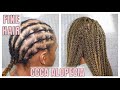 NEW TECHNIQUE | ALOPECIA | FINE HAIR | HAIR LOSS | BOX BRAIDS | DEDE AT HOME