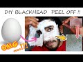 I tried EGG WHITE Blackheads PEEL of MASK for the first time & This Happened 😱 DIY ഹോംറെമഡി mens try