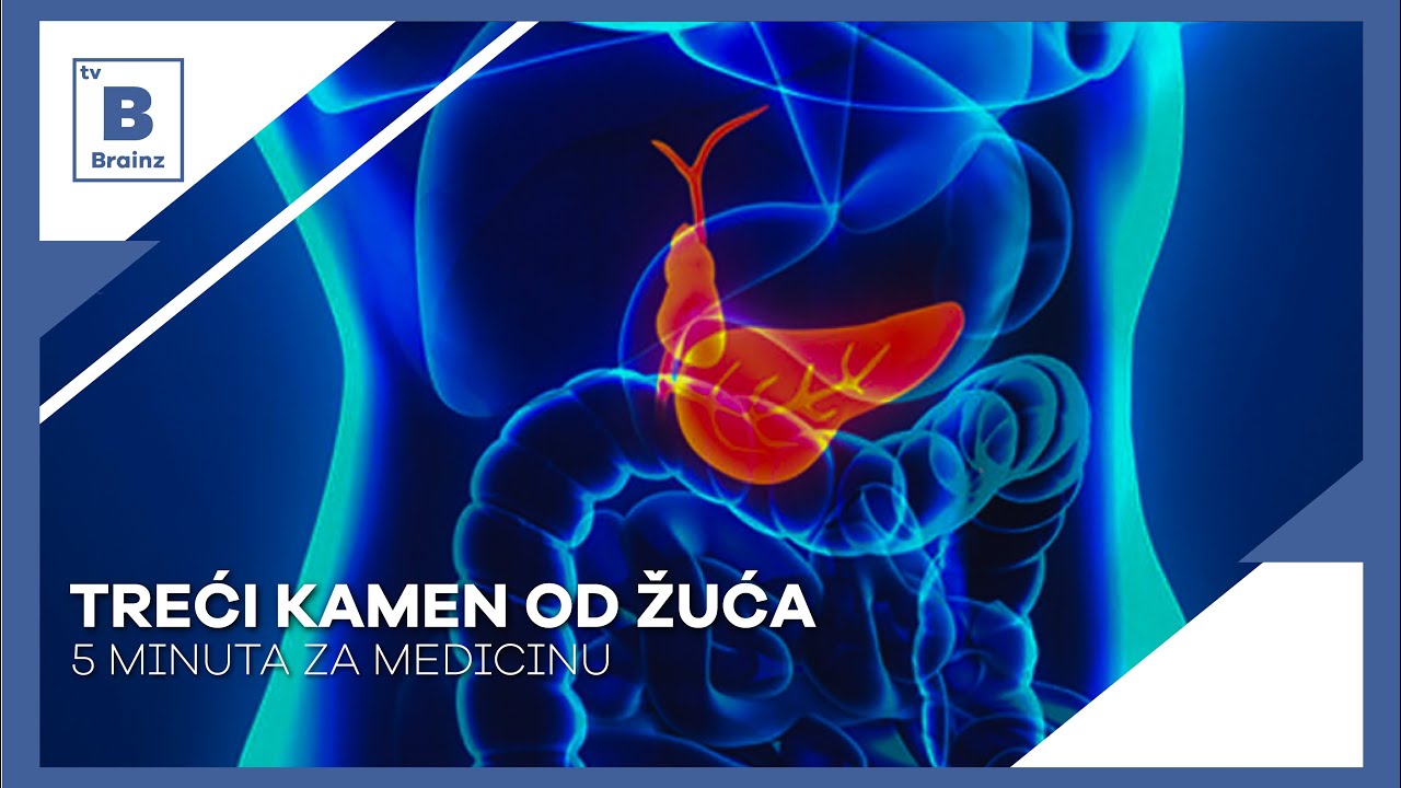 5 minuta za medicinu - Treći kamen od žuća