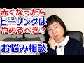 ピーリングジェルの正しい使い方※赤くなったらやめるべき？【お悩み相談】