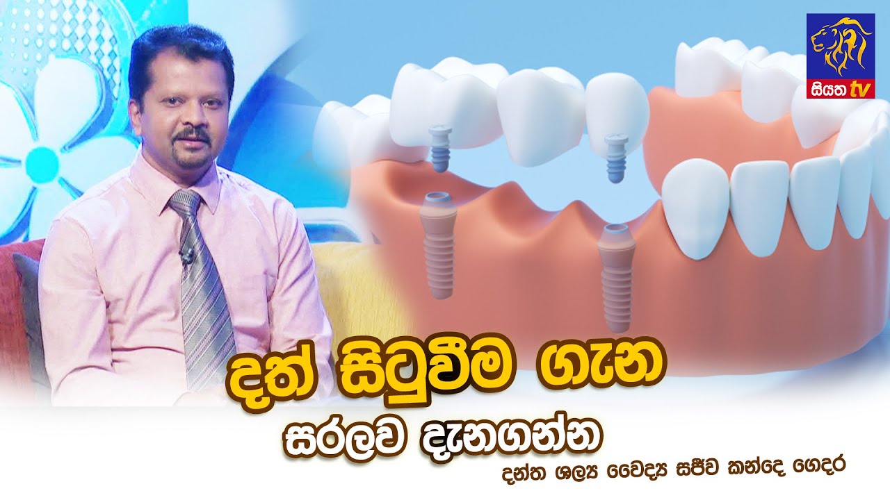 දත් සිටුවීම ගැන සරලව දැනගන්න | Sajeewa kande Gedara | Adaraneeya Jeewithaya