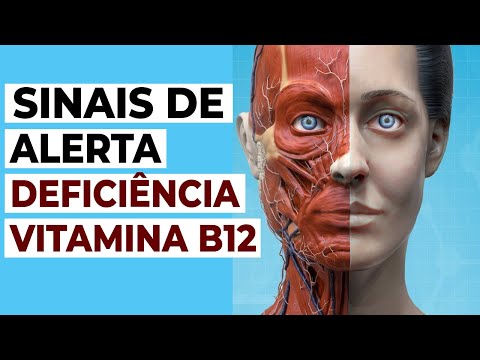 10 Sintomas de Deficiência de Vitamina B12 que Você Nunca deve Ignorar