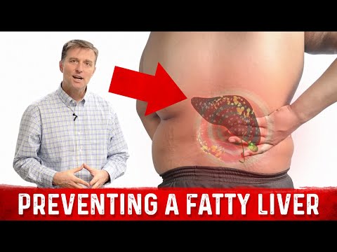 Preventing a Fatty Liver as You Lose Weight