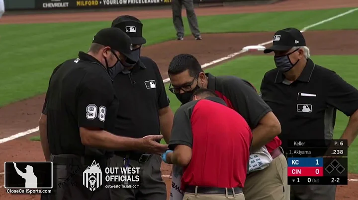 Injury - Umpire Chris Conroy Hit by Ball to Hand, ...