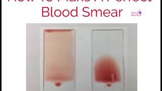 How to Make a Perfect Blood Smear | Spicy MedTech | Blood Smear Tutorial