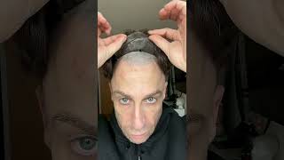 PARRUCCA INVISIBILE?LA MIA TESTIMONIANZA–AUTOSTIMA GARANTITA!#lordhair #parrucca #testimonialvideos